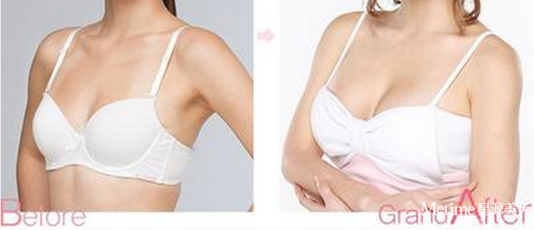 ����֬��¡����ά�ֶ��