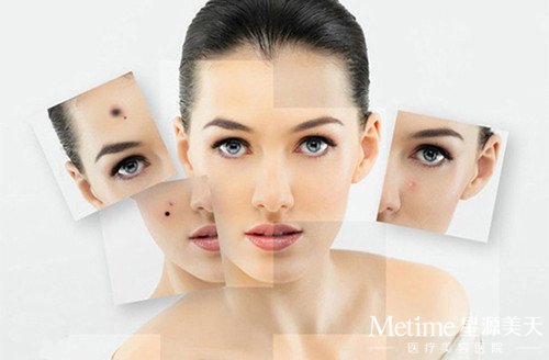 激光美白能保持多久