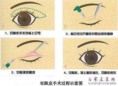 ����Դ ���Լ�һ˫���Ĵ��۾�