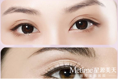 ��ʽ�����������ߺò��� 