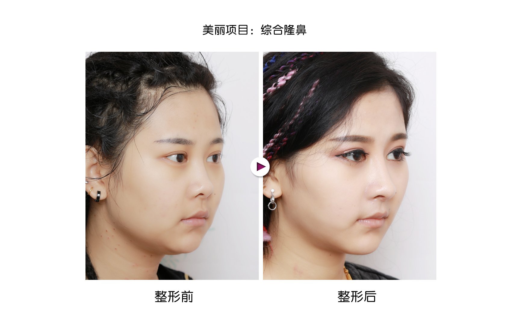 ¡���޸���Ч�����