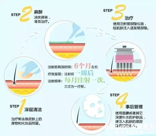 说了半天 水光针怎么做?变美三步走