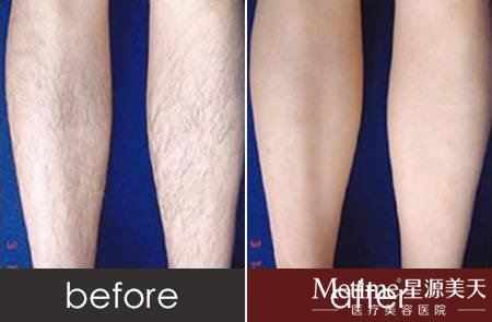 ������ë������