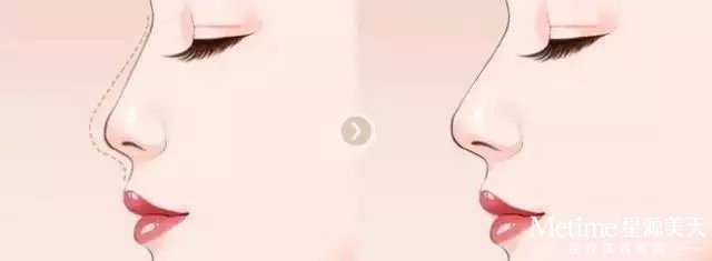 ע��¡�Ǻò���