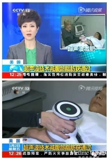 超声溶脂减肥好不好