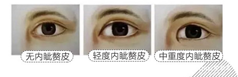 ��Ƥ�ɳ�������ô��