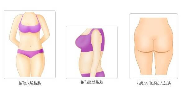 石家庄自体脂肪填充哪家好