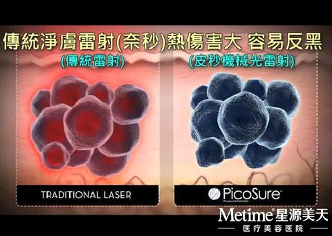 Ƥ�뼤���봫ͳ�������������