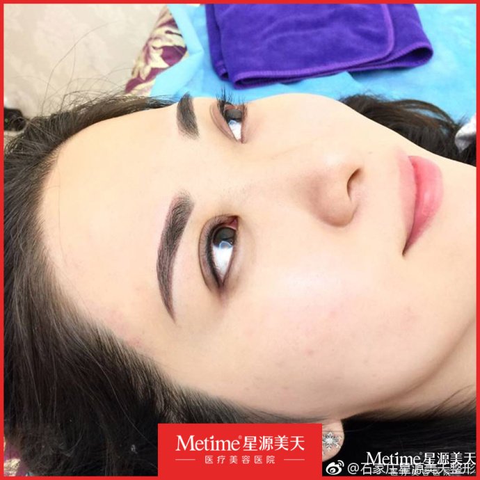 ��ͫ���ʺ���Щ��