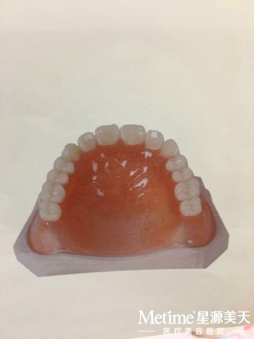 ���ݵĽ���ģ��ͼ