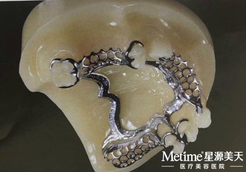 ��ͨ�Ļ����