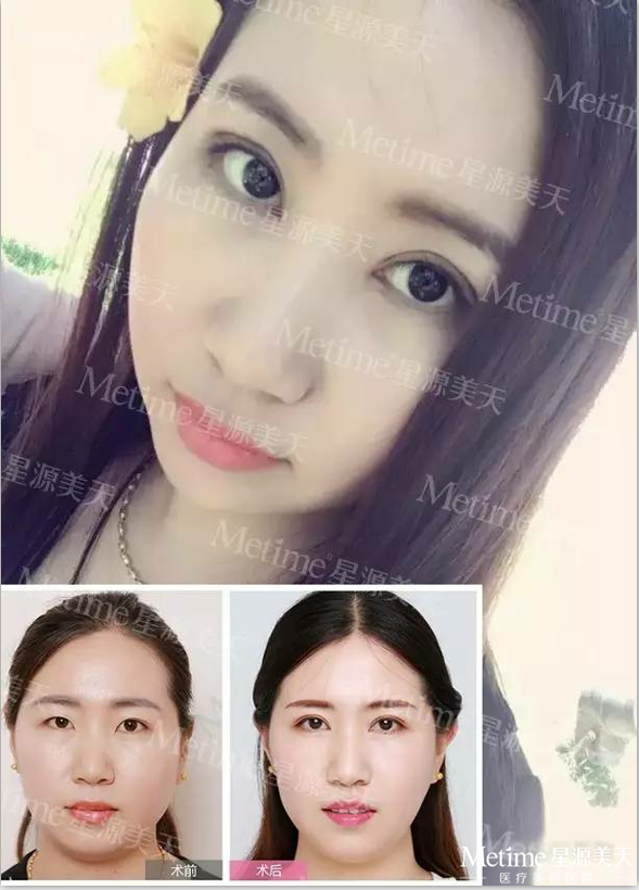 ˫��Ƥ����Ա�ͼ