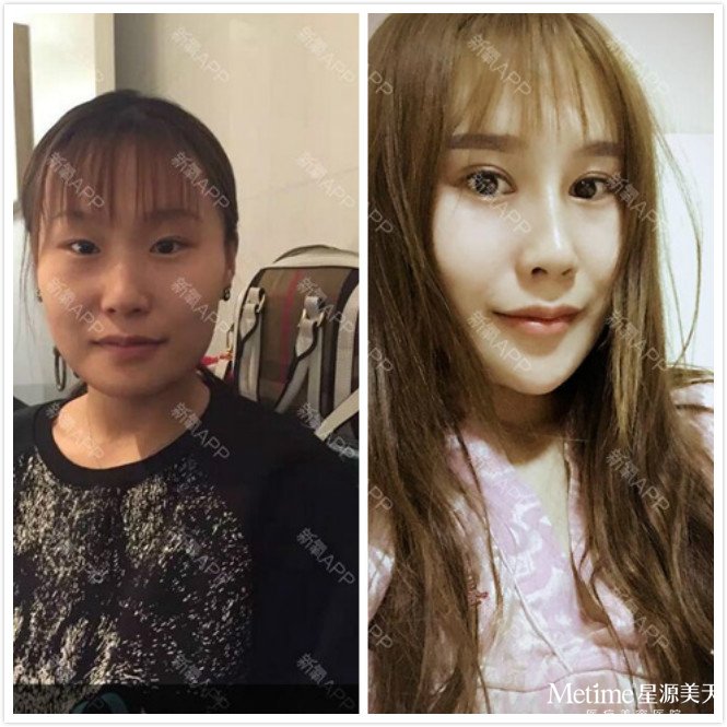 z��ȷ�ľ���Ī��������˫��Ƥ��