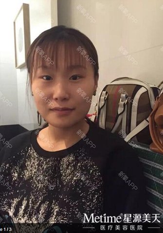 ��POһЩ��ǰ����