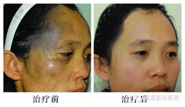 ̫���뻼����Ůʿ����ǰ��Ա���