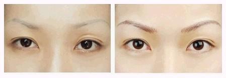 星源韩式纹眉真人案例