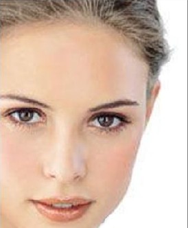 玻尿酸丰太阳穴理想效果