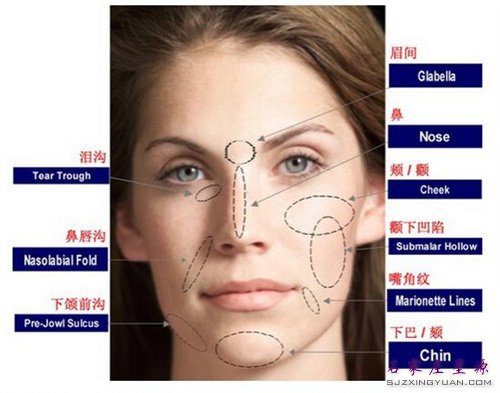 �沿��䲿λ ʾ��ͼ