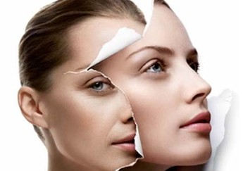 玻尿酸填充鼻唇沟优势