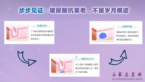 注射玻尿酸 轻松变美第一步