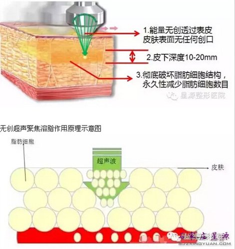 �޴��۽�������֬ԭ�� ʾ��ͼ