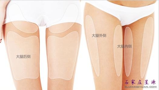 石家庄腿部吸脂手术贵不贵