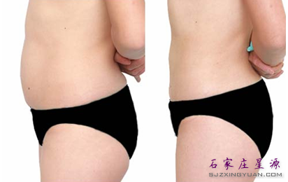 ��֬����ȥ������֬��