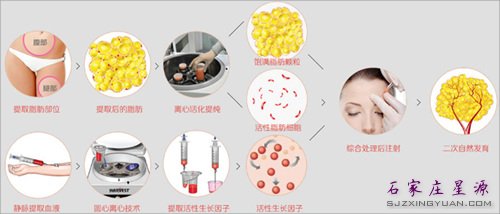 面部年轻化要素一:额头