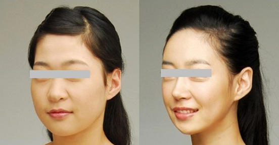 ע������