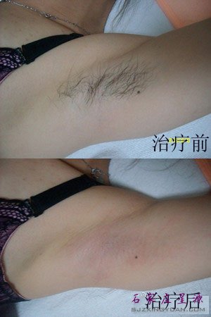 ��Դ��ë��Ǯ�ȽϺ���