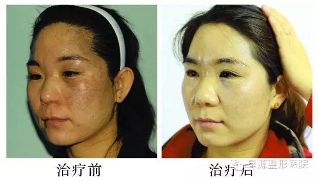 ̫���뻼����Ůʿ����ǰ��Ա���