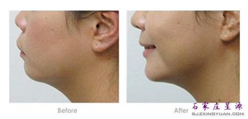 �沿��� �Ա�ͼ��