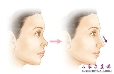 �ǹ�������Ǿ������ӵ���̬