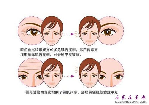 ע���ⶾ�� ���ƶ�̬������Ч����