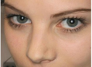 鼻翼缩小手术价格不是固定的