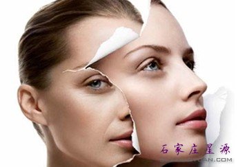 热玛吉——女性抗衰的理想之选