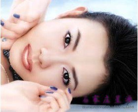 玻尿酸丰下巴效果不错