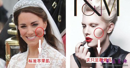 苹果肌?颧骨高?你能分清吗