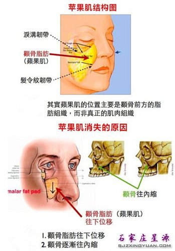 苹果肌