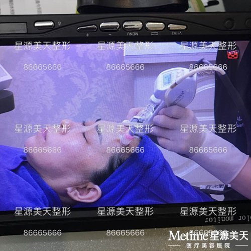 现场直播治疗过程