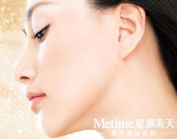 玻尿酸丰鼻唇沟价格不是固定的