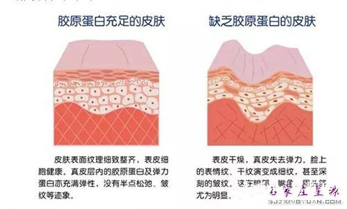 注射胶原蛋白原理 如图示