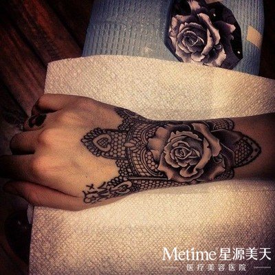 激光能洗纹身吗