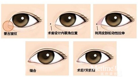 如何快速放大双眼