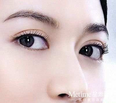 做双眼皮失败了如何修复好