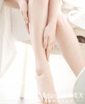 激光脱毛靠谱吗