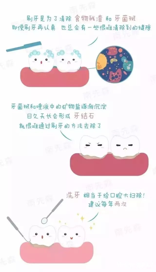 洗牙会让牙缝变大吗?