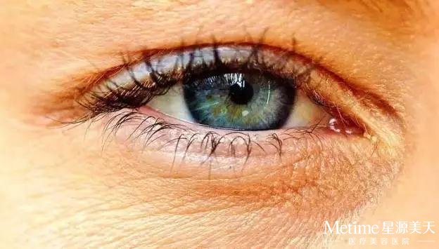 眼部皮肤是最疲劳的 据了解,每天每人的眨眼次数达2.4-2.