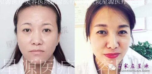 星源安医生真切体验 拒绝复制!