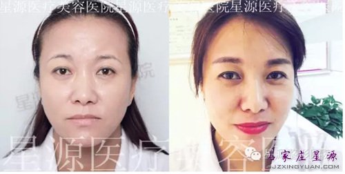 拒绝复制,不同的美属于同一个你